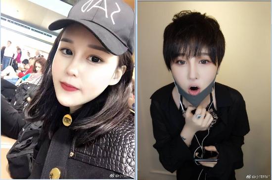 赵本山女儿球球直播承认整容:看我爹就知道